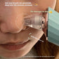 Suction Blackhead Removal